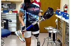 prosthetic amputees amputee legs prosthetics robotic bionic forward