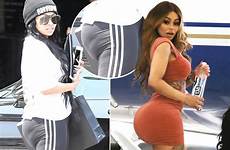 blac bum chyna collapses filler implants redford arse