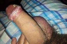 smegma uncut tumbex foreskin unwashed smelly filthy