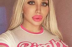 bimbo huge bimbos ivana vladislava lips alicia amira fillers surgery breast hypersexualized eden fuckable