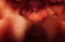 giantess pov mouth vore giantesskatelyn tumblr katelyn open store endoscope ending perfect slave tooth life brooks