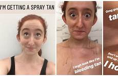 tan spray skin pale littlethings first when happened courtesy author getting