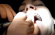 dentist dental braces fetish ago years