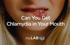 chlamydia mouth