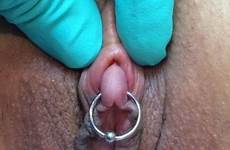 clit pierced piercing clitoris ring sex vinco bdsm clitless klitoris clitoridectomy fgm