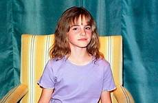 emma watson young years childhood stone old legs galleries