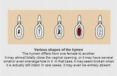 hymen does look why myths