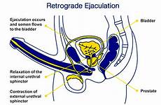 male ejaculation retrograde health