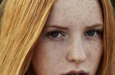 sommersprossen freckles redhead redheads vault rousses hijas llaman gingerhair freckle pale