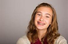 braces teenager orthodontics teenage smile
