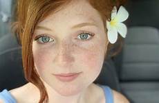 annah freckles freckle freckledgirls redheads copper thoughts