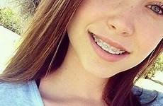 freckles braces myteenwebcam tween brace cutest hustler selfshot panties worlds