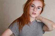 freckles redheads
