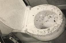 toilet explosion feces covered woman after sues baltimore literally her exploded city being upi left explodes march contractors suing injured
