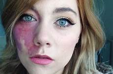 woman ugly birthmark too her she facial told undateable years next makeup