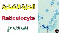 حلقة عملي تقدير نسبة الخلايا الشبكية Reticulocyte count 🩸