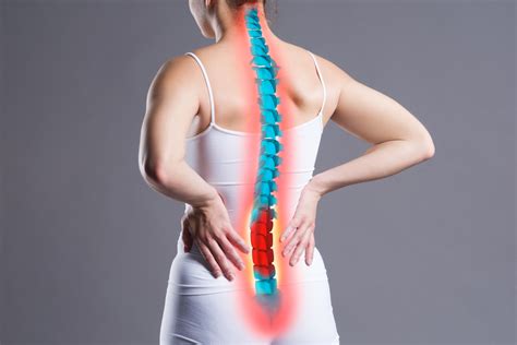 Compression Fractures and Osteoporosis | Louisiana Pain ...