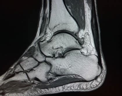 Nein, natürlich nicht die bauten an sich. Beispielhafte Bilder von Kopf bis Fuß - Radiologische ...