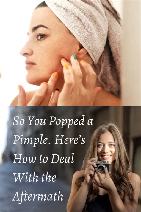 How to heal open pimple wound fast. So You Popped a Pimple. Here's How to Deal With the Aftermath