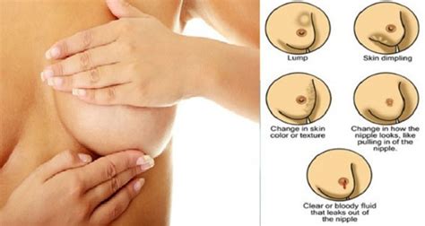 Breast cancer is a disease impacting the lives of millions of women. EARLY WARNING SIGNS OF BREAST CANCER NO ONE TALKS ABOUT ...