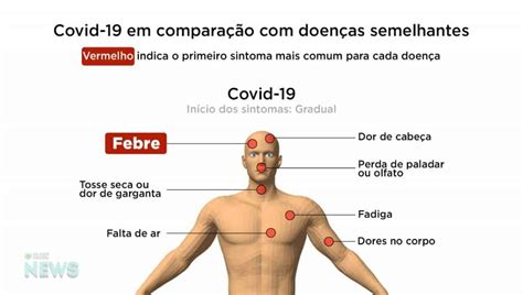 Algunas personas se contagian pero no notan los síntomas. Saiba as diferenças entre os sintomas da Covid-19 e de ...