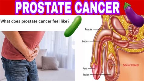 Reveals prostate cancer in 39% and this. PROSTATE CANCER , [Signs And Symptoms ,Causes ,Diagnosis ...