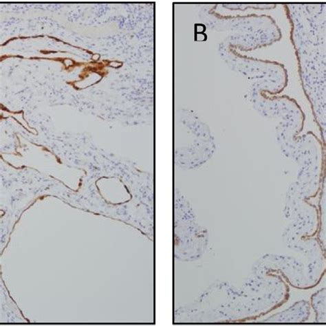 Mesothelioma experts · latest clinical trials · top cancer centers Hassan AZIZ | Transplant/HPB Fellow | University of ...