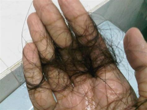 Hampir kebanyakan wanita akan mengalami masalah keguguran rambut selepas bersalin. 7 Punca rambut gugur sampai botak? - Mauceriasokmo