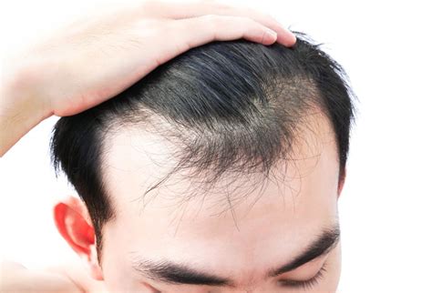 It reduces the risk of cardiovascular disease and also may prevent certain. How Can I Regrow Hair? ~ Tips to Naturally Regrow Your Hair