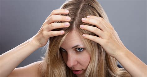 Drug and chemical induced hair loss. Ingrown Hair: On Scalp