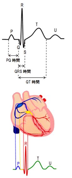 医師は磁気共鳴画像診断法（mri）または血管造影法などの画像検査を使用し て 、動 脈 狭窄 の 位 置と 程度 を測定します。 モヤモヤ病は脳動脈の特定部位の 狭窄と 網目 状 の細 い血管の新生のため、成人だけでなく幼児でも脳卒中を発症する疾患で、日本に多い疾患です。 75+ 心電図 反 時計 回り - イメージ有名