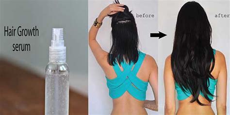 How much does your hair grow? This Natural Hair Growth Serum Can Grow 4 Inches Hair ...