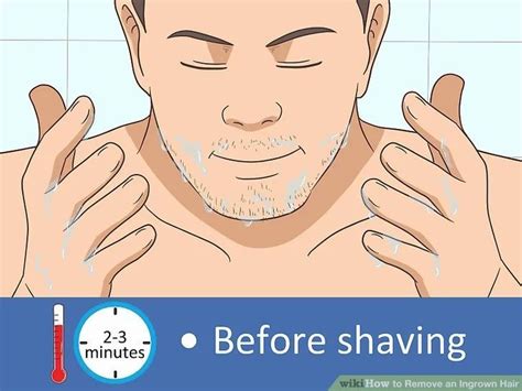 You can even crush the aspirin a bit to help it dissolve better. How to Remove an Ingrown Hair | Ingrown hair, How to ...