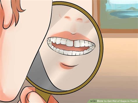 Gapped teeth, also known as diastemas, are one of the most common dental issues and can result from several issues How To Fix Gap Teeth Naturally : How to fix gap between ...