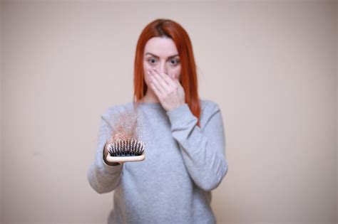 But sometimes hair loss and shedding may be related to severe dandruff. Can Dandruff Causes Hair Loss? [Causes And Prevention ...