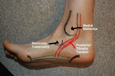 Die königin der erotischen massagen. Some great surface anatomy of the foot in this post and ...