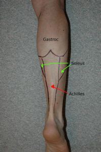 Section editor dean taylor, md. Muscle of the upper leg (anterior view) | Anatomy ...