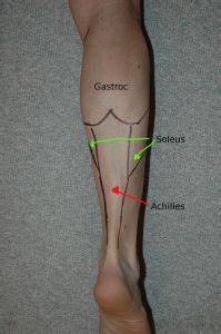 Section editor dean taylor, md. Muscle of the upper leg (anterior view) | Anatomy ...