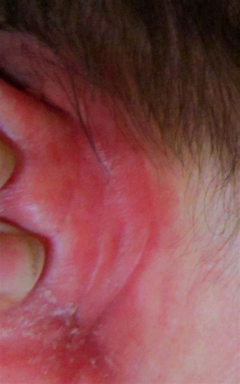 Regaine® frauen, regaine® frauen schaum. Forum Haarausfall Frauen: Forum Frauen » minoxidil 2% ...