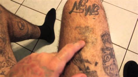 If you also used the herb tattoo removal at home method before, write a comment down below! Salabration Home Tattoo Removal: 1 Year RESULTS!!! - YouTube