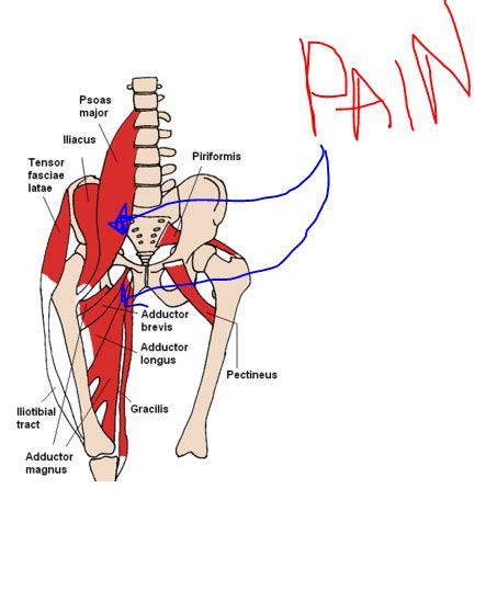 A pulled groin muscle can happen after a fall, during exercise. It's all about Pace: The groin thing….