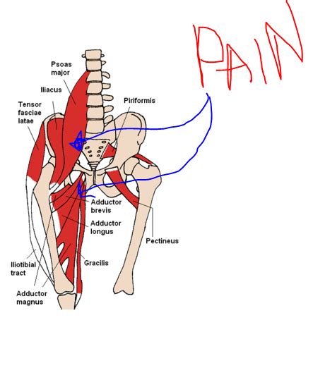 Superficial structures of the groin. It's all about Pace: The groin thing….