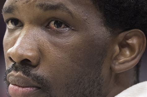 He elbowed jarrett allen in the face. PHOTO A Look at Joel Embiid's Face Mask