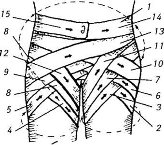 Колосовиданая повязка является сложной повязкой даже для опытных врачей. Повязки на живот и таз - Хирургия
