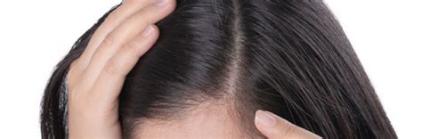 Certain medical conditions may also lead to thinning hair. Why is my hair so thin - Hair Colors