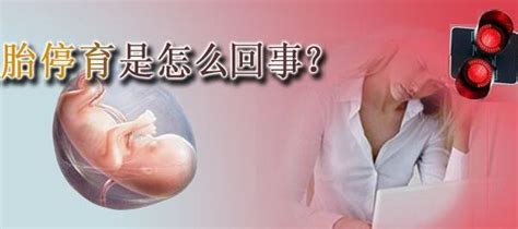 本网站使用 cookie。 继续浏览本网站即表示您同意我们使用 cookie。 查询更多. 美国试管婴儿如何避免胚胎15号染色体三体？ - 梦美生命