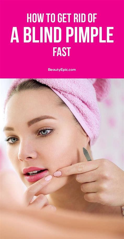 Dermatologist tested · levels of exfoliation · plastic microbead free 13 Easy Ways to Get Rid of Blind Pimple Fast | Acne ...