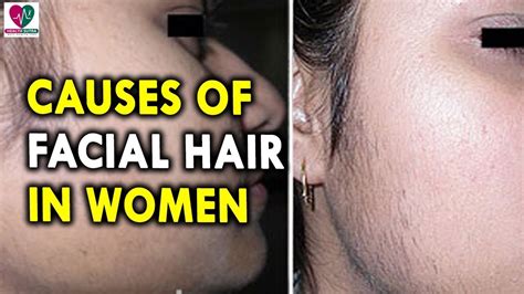 There are some diseases or syndromes which can cause excess hair growth in women, and one of these is called polycystic ovary disease. Causes of Facial Hair in Women - Womens Health Tips - YouTube