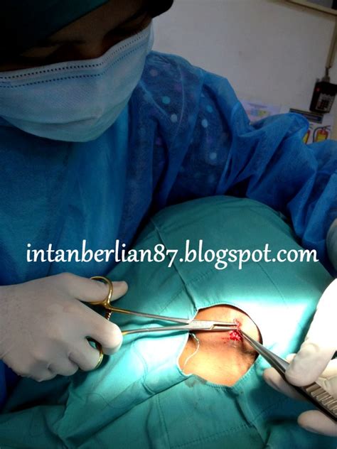 Sultanah fatimah specialist hospital (malay: Hasilnya setelah 4 bulan menuntut ilmu di Oral Surgery ...