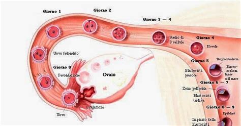 In medicina, si definisce gravidanza ectopica quella condizione patologica in cui l'impianto dell'embrione avviene in sedi diverse dalla cavità uterina. Gravidanza extrauterina: Come riconoscerla? ~ Test Gravidanza